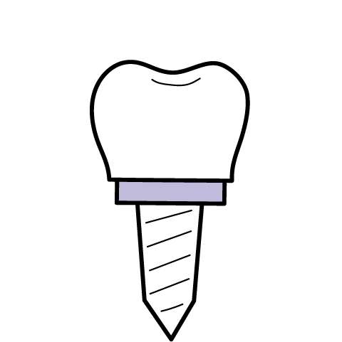 Dental Restoration